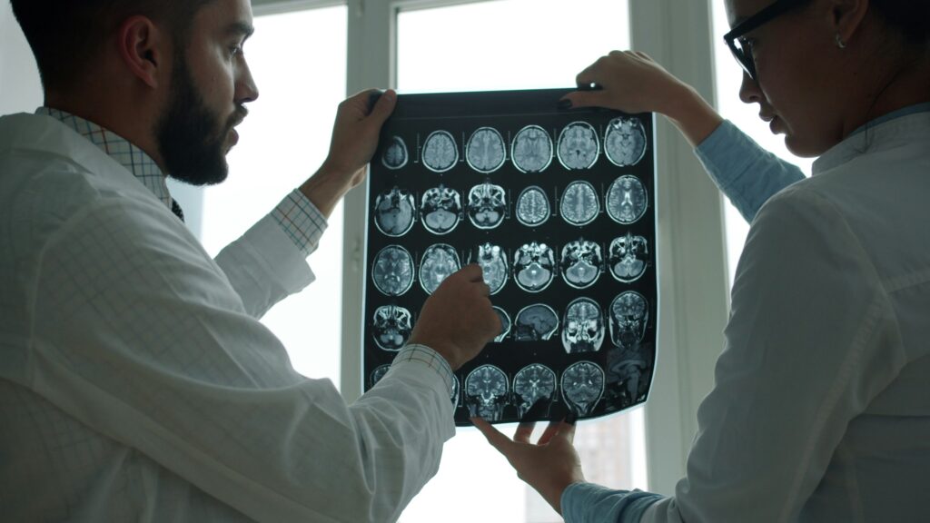 When a Head Injury Changes Everything: Practical Help from a Milwaukee Brain Injury Lawyer